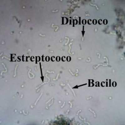 Bacterias del yogurt. Observación real al microscopio.