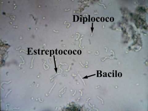 Bacterias del yogurt. Observación real al microscopio.